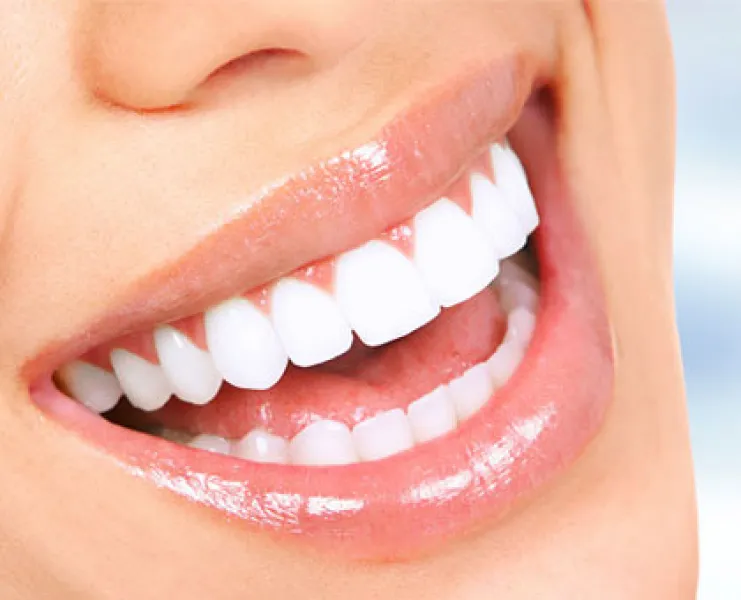 Estética dental 